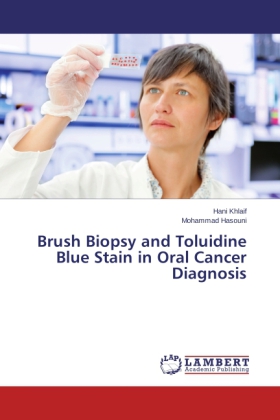 Brush Biopsy and Toluidine Blue Stain in Oral Cancer Diagnosis 