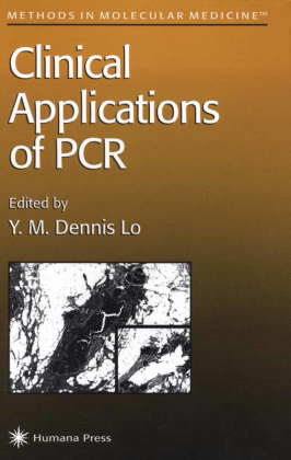 Clinical Applications of PCR 