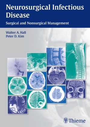 Neurosurgical Infectious Disease 