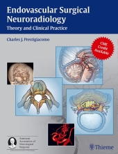 Surgical Endovascular Neuroradiology