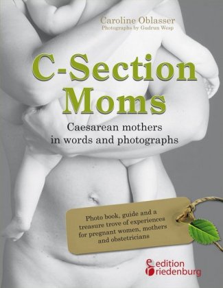 C-Section Moms - Caesarean mothers in words and photographs 
