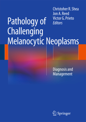 Pathology of Challenging Melanocytic Neoplasms 