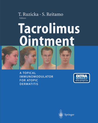 Tacrolimus Ointment 