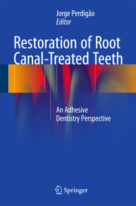 Restoration of Root Canal-Treated Teeth 
