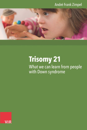 Trisomy 21 