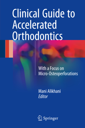Clinical Guide to Accelerated Orthodontics 
