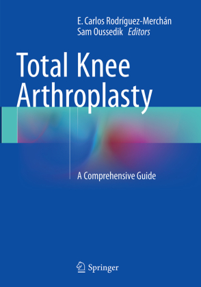 Total Knee Arthroplasty 