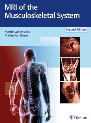 MRI of the Musculoskeletal System 