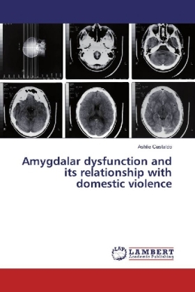 Amygdalar dysfunction and its relationship with domestic violence 