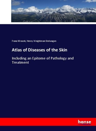 Atlas of Diseases of the Skin 