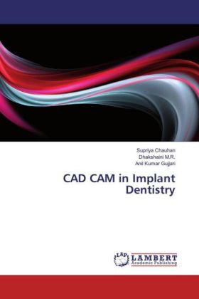 CAD CAM in Implant Dentistry 