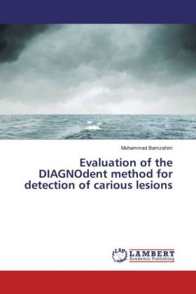 Evaluation of the DIAGNOdent method for detection of carious lesions 