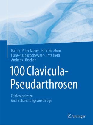 100 Clavicula-Pseudarthrosen 