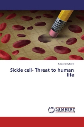 Sickle cell- Threat to human life 