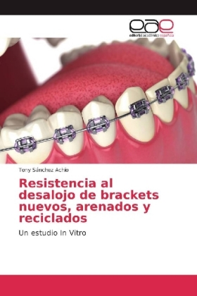 Resistencia al desalojo de brackets nuevos, arenados y reciclados 