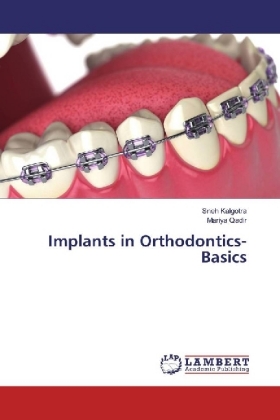 Implants in Orthodontics- Basics 