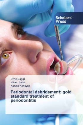 Periodontal debridement: gold standard treatment of periodontitis 