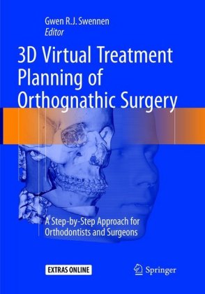 3D Virtual Treatment Planning of Orthognathic Surgery 