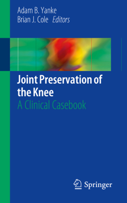 Joint Preservation of the Knee 