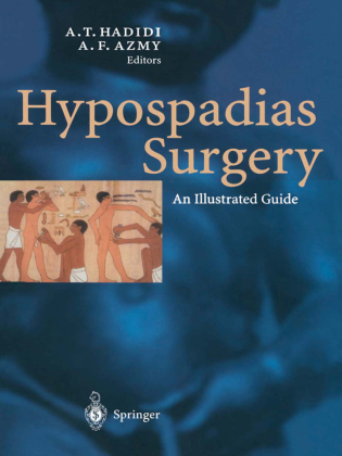 Hypospadias Surgery 