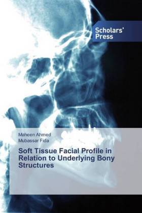 Soft Tissue Facial Profile in Relation to Underlying Bony Structures 