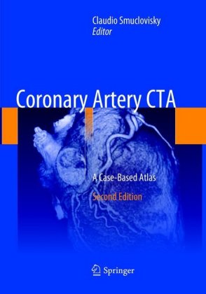 Coronary Artery CTA 