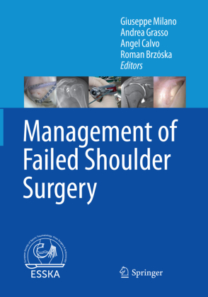 Management of Failed Shoulder Surgery 