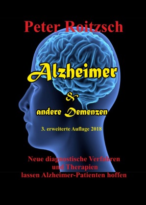 Alzheimer & andere Demenzen 