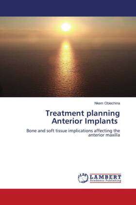 Treatment planning Anterior Implants 