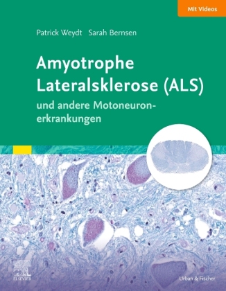 Amyotrophe Lateralsklerose (ALS) und andere Motoneuronerkrankungen