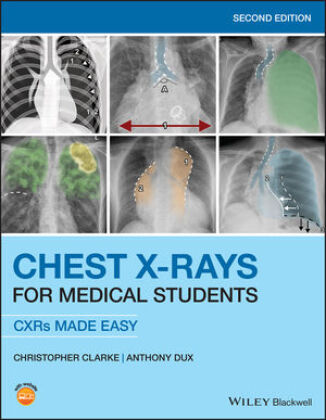 Chest X Rays For Medical Students Produkt