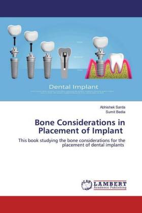 Bone Considerations in Placement of Implant 