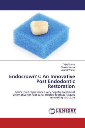 Endocrown's: An Innovative Post Endodontic Restoration 