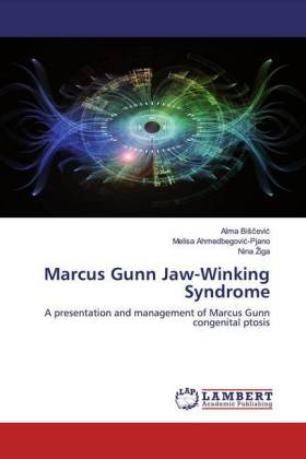 Marcus Gunn Jaw-Winking Syndrome 