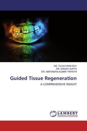 Guided Tissue Regeneration 