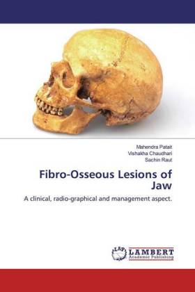 Fibro-Osseous Lesions of Jaw 