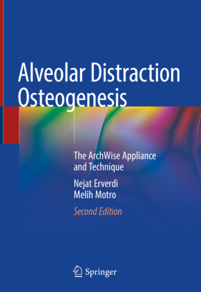 Alveolar Distraction Osteogenesis 