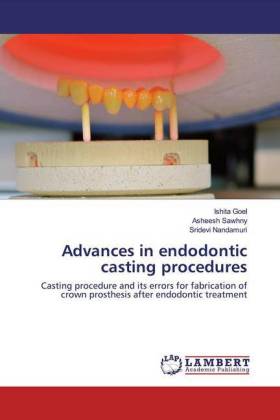 Advances in endodontic casting procedures 