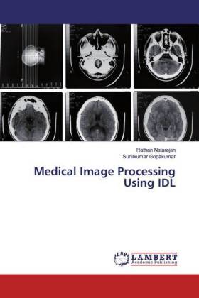 Medical Image Processing Using IDL 