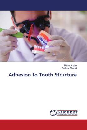 Adhesion to Tooth Structure 