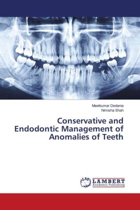 Conservative and Endodontic Management of Anomalies of Teeth 