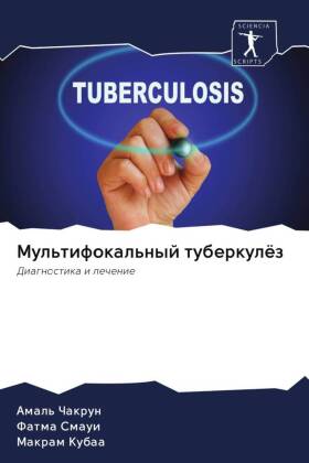 Mul'tifokal'nyj tuberkulöz 
