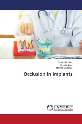 Occlusion in Implants 