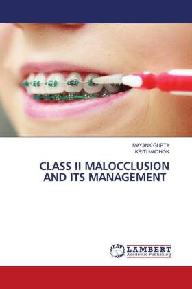 CLASS II MALOCCLUSION AND ITS MANAGEMENT 
