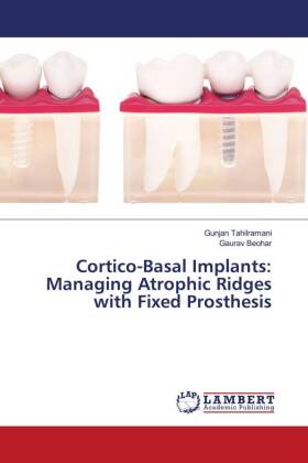 Cortico-Basal Implants: Managing Atrophic Ridges with Fixed Prosthesis 