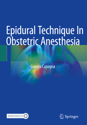 Epidural Technique In Obstetric Anesthesia 