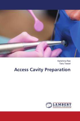 Access Cavity Preparation 