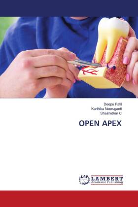OPEN APEX 