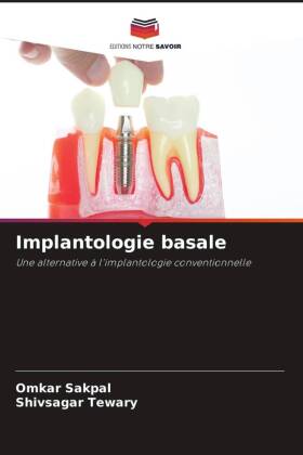 Implantologie basale 