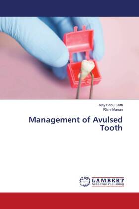 Management of Avulsed Tooth 